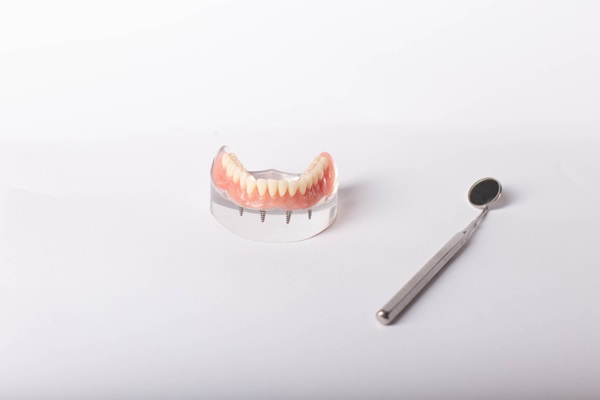 How Long Does It Take To Get Implant Supported Dentures?